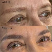 EL AUGE DE LA CORRECCIÓN DE CEJAS: ERRORES COMUNES, SOLUCIONES REALES