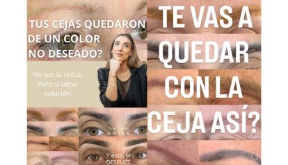 EL AUGE DE LA CORRECCIÓN DE CEJAS: ERRORES COMUNES, SOLUCIONES REALES