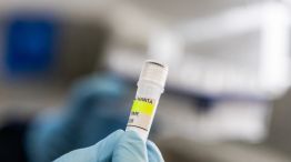 Hantavirus_investigación