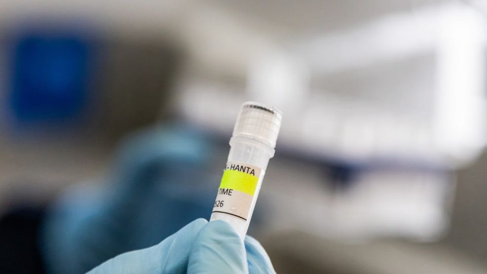 Hantavirus_investigación