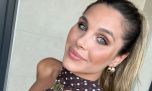 Ivana Icardi mostró el antes y después de la particular cirugía estética que se realizó: "Se me fue de las manos"