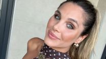 Ivana Icardi mostró el antes y después de la particular cirugía estética que se realizó: "Se me fue de las manos"