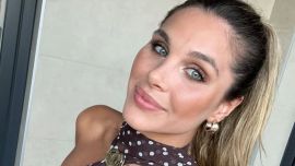 Ivana Icardi mostró el antes y después de la particular cirugía estética que se realizó: "Se me fue de las manos"