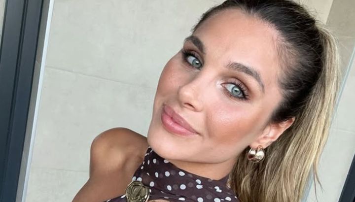 Ivana Icardi mostró el antes y después de la particular cirugía estética que se realizó: "Se me fue de las manos"
