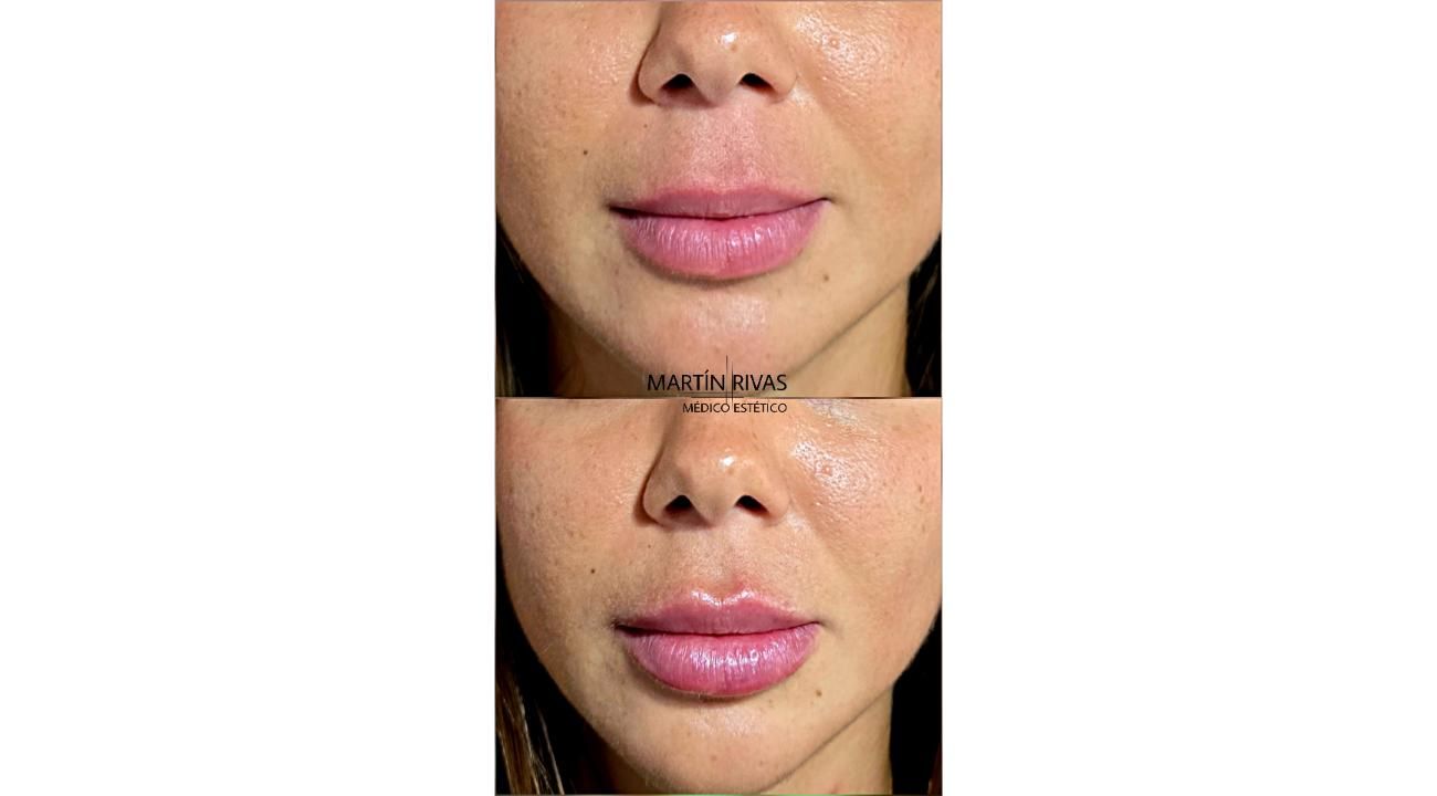 MR Medicina Estética: un lugar… dos profesionales en quienes confiar