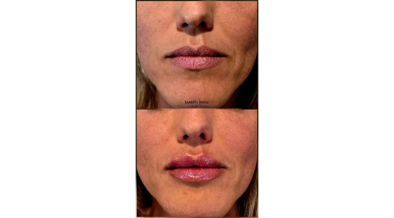MR Medicina Estética: un lugar… dos profesionales en quienes confiar
