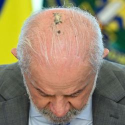 El presidente de Brasil, Luiz Inácio Lula da Silva, inclina la cabeza, mostrando la cicatriz de una cirugía de cáncer de piel a la que se sometió el mes pasado, durante la promulgación de la ley que establece un Día Nacional de Recuerdo de las Víctimas de la COVID-19 en Brasilia. | Foto:EVARISTO SA / AFP