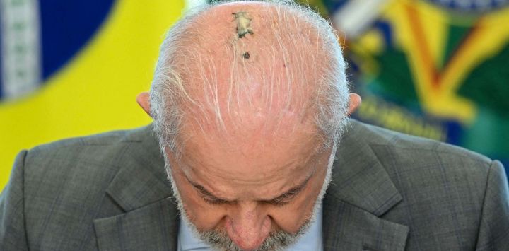 El presidente de Brasil, Luiz Inácio Lula da Silva, inclina la cabeza, mostrando la cicatriz de una cirugía de cáncer de piel a la que se sometió el mes pasado, durante la promulgación de la ley que establece un Día Nacional de Recuerdo de las Víctimas de la COVID-19 en Brasilia.