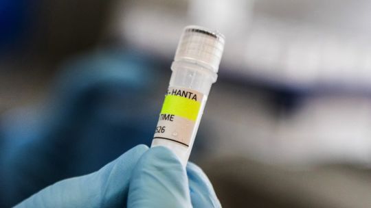Health body investigating hantavirus hit by fresh Milei budget cuts