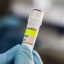 Health body investigating hantavirus hit by fresh Milei budget cuts
