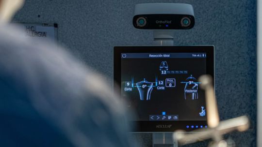 Nuevo navegador de rodilla en Hospital Privado: innovación y mayor precisión