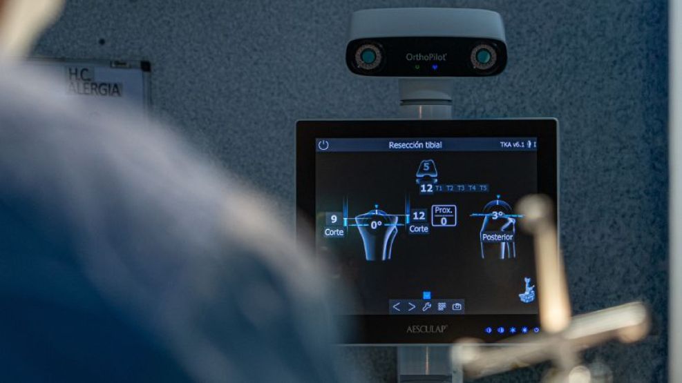 Nuevo navegador de rodilla en Hospital Privado: innovación y mayor precisión