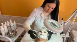 Temporada de Peeling: el tratamiento que renueva la piel y gana cada vez más popularidad
