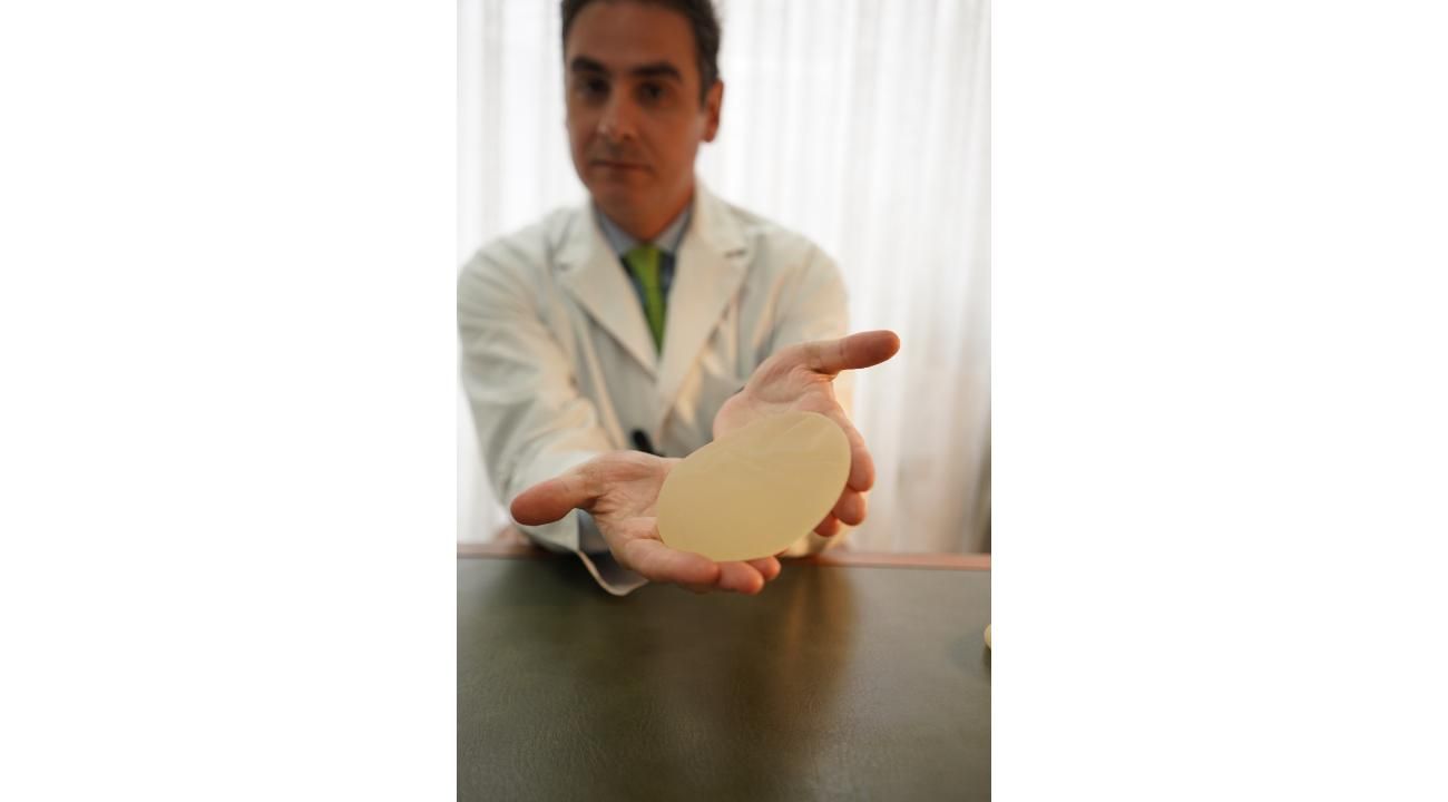 Explantación mamaria: una tendencia creciente que exige alta especialización y una visión estética para lograr resultados satisfactorios