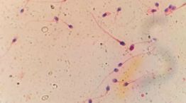 HyperSperm 