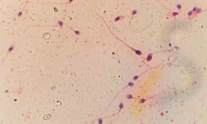 HyperSperm 