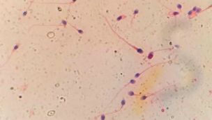 HyperSperm 