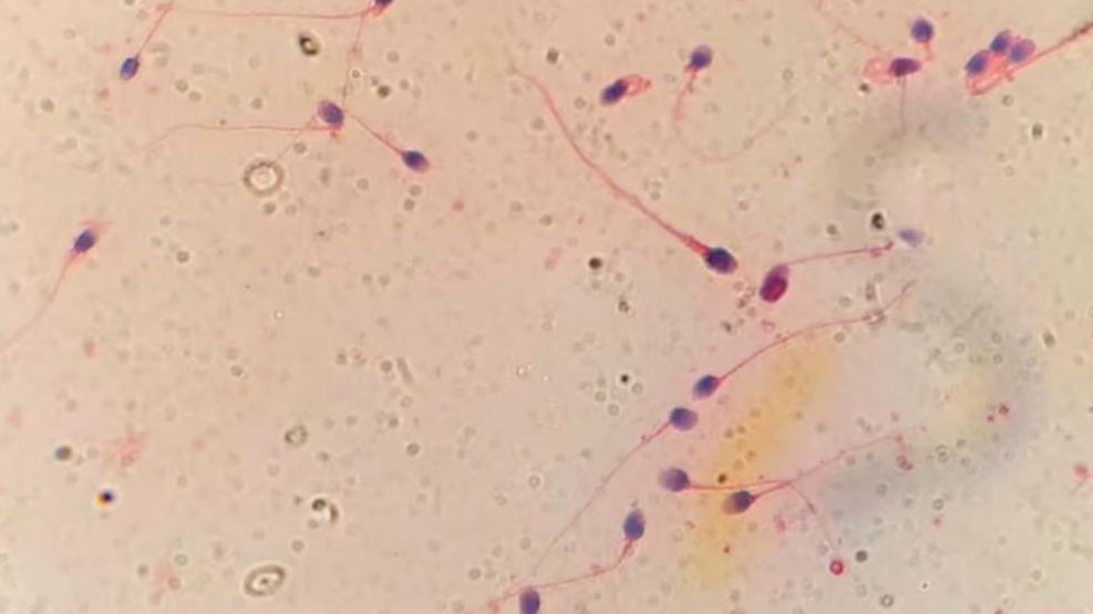HyperSperm 
