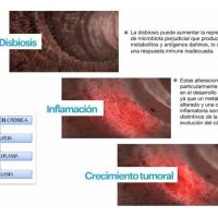 Tu intestino también se comunica con tu cerebro
