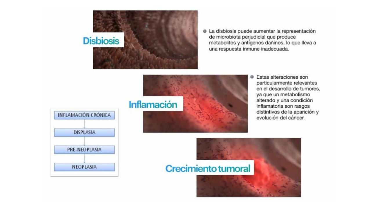 Tu intestino también se comunica con tu cerebro