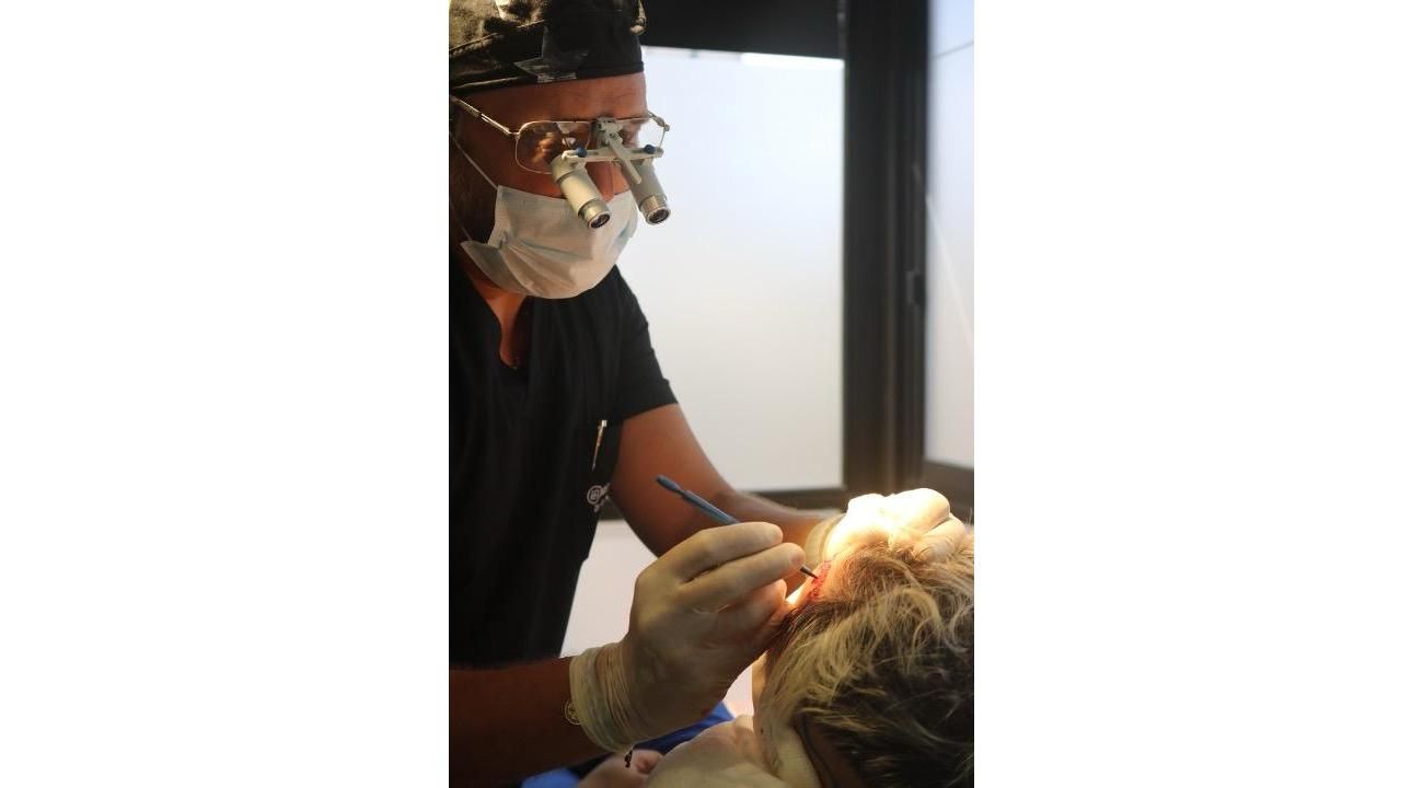 Dr. Gastón Forza: especialista en alopecia e implante capilar