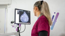 Salud mamaria: cómo es el abordaje integral del cáncer de mama en el Hospital Privado Universitario de Córdoba
