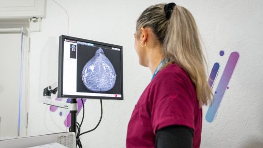 Salud mamaria: cómo es el abordaje integral del cáncer de mama en el Hospital Privado Universitario de Córdoba