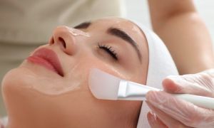 Peeling Ultra White, el más deseado.