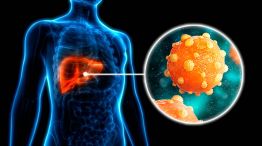 Hepatitis 26072026 