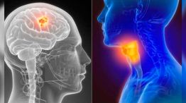 Mundial del Cáncer de Cabeza y Cuello 27072026