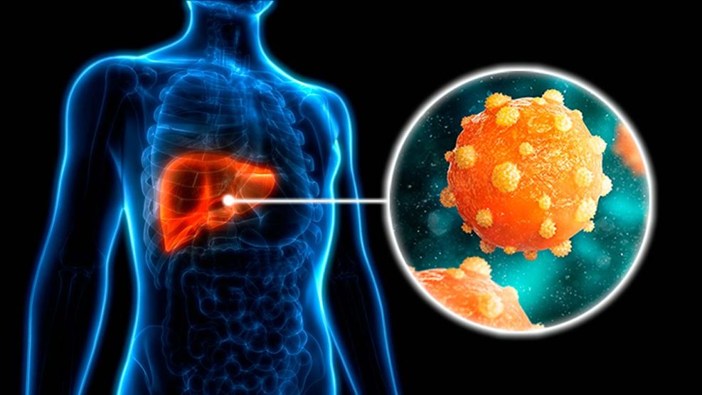 Hepatitis 26072026 