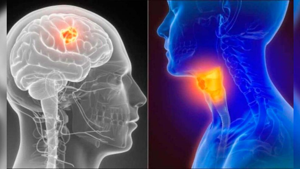Mundial del Cáncer de Cabeza y Cuello 27072026