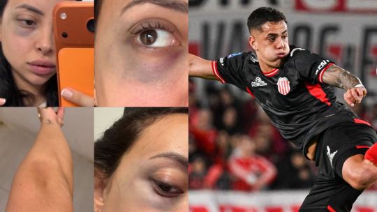 Gonzalo Morales fue denunciado públicamente por su ex pareja por violencia de genero