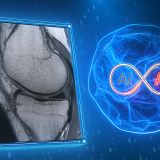 Philips presenta SmartSpeed Precise
