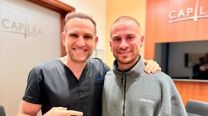  Alexis Mac Allister cumplió y se implantó pelo antes de volver al fútbol inglés