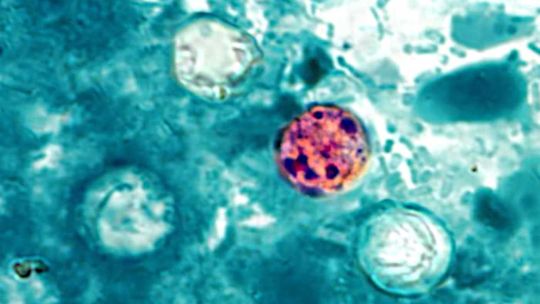 Confirmaron las primeras muertes en Estados Unidos por un brote masivo de ciclosporiasis