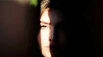 Endolifting: el tratamiento que conquista la medicina estética por una razón muy simple: los resultados se ven naturales
