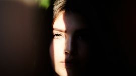 Endolifting: el tratamiento que conquista la medicina estética por una razón muy simple: los resultados se ven naturales