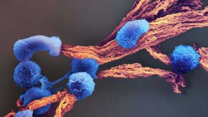09_08_2026_cancer_freepick_g