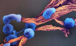 09_08_2026_cancer_freepick_g