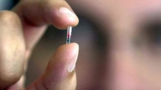 Niñas de 11 años y anticonceptivos: qué dice la ley sobre el acceso a un "Chip Sexual"