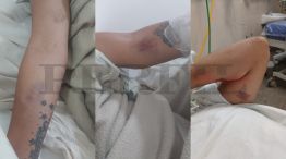 La joven compartió fotografías de las heridas que sufrió.
