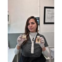 ¿Los implantes se rechazan? Las creencias que todavía hacen que muchos pacientes lleguen tarde al consultorio
