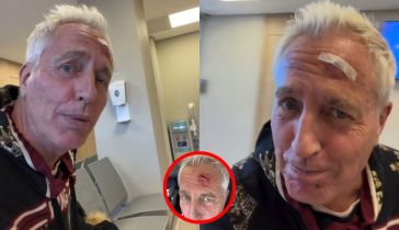 Marley sufrió un accidente en su cabeza