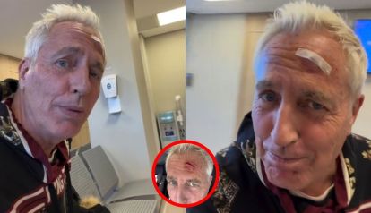 Marley sufrió un accidente en su cabeza