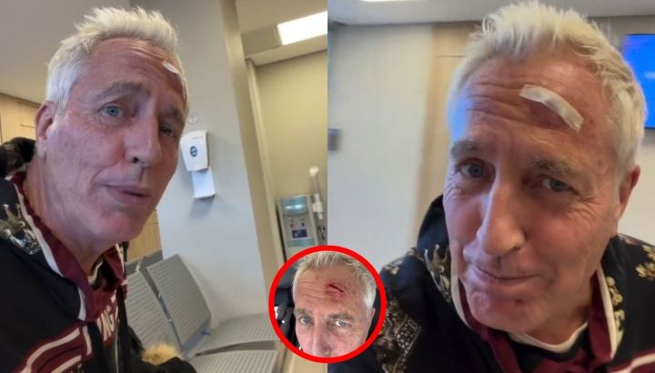 Marley sufrió un terrible accidente: "Me rompí la cabeza"