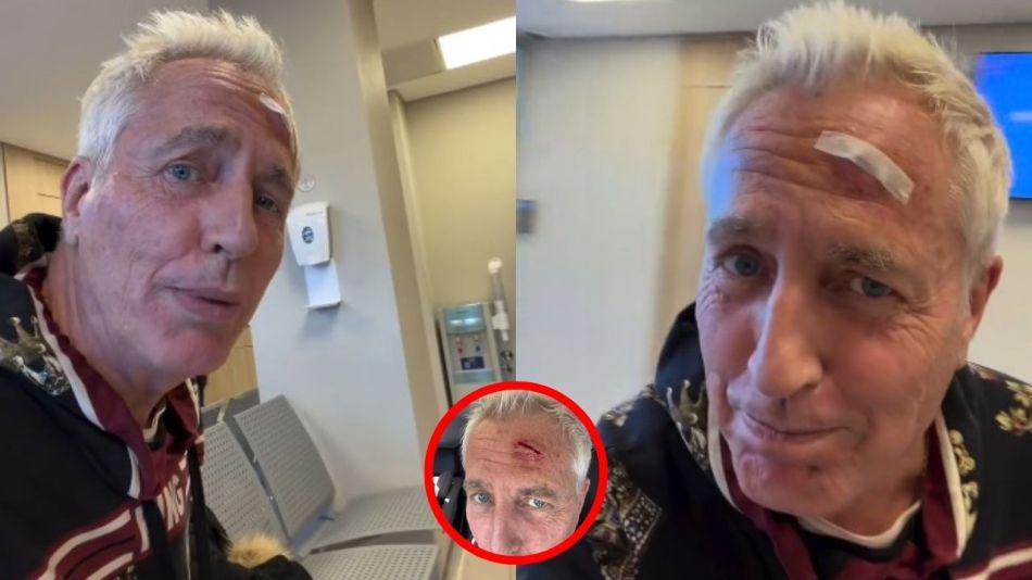 Marley sufrió un accidente en su cabeza
