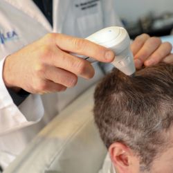 Alopecia | Foto:CEDOC