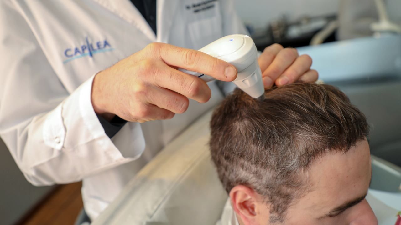 Alopecia | Foto:CEDOC