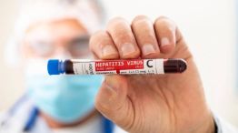 Hepatitis C